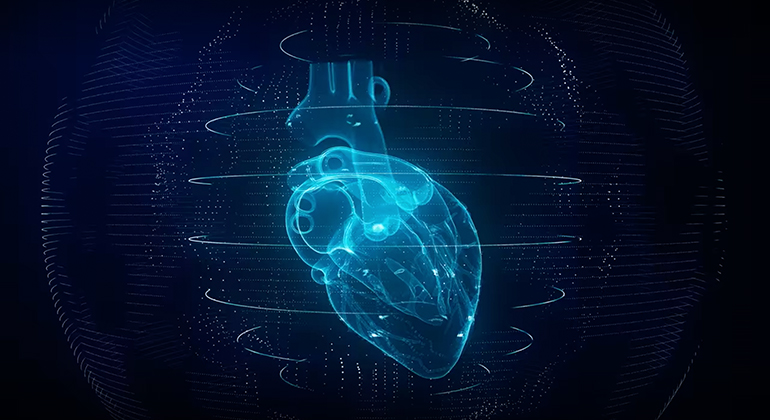 Visual reference of how artificial intelligence and machine learning is used in cardiology (Photo credit: Medtronic)
